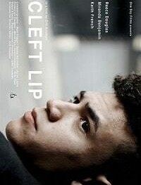 Заячья губа